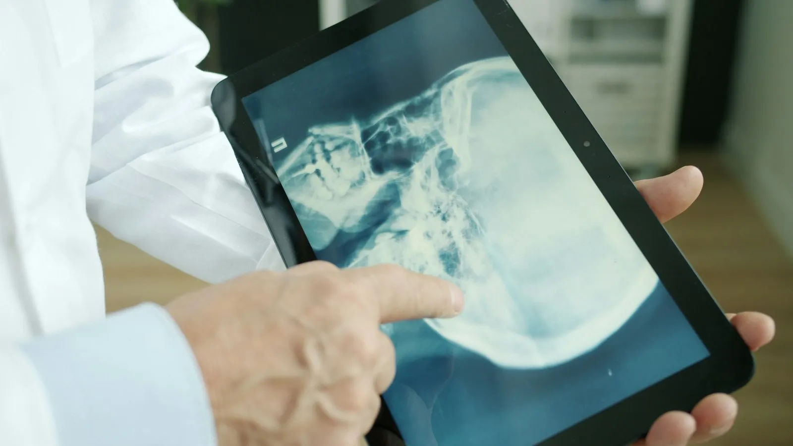 Queens car accident broken bones lawyer: doctor pointing at an X-ray on a tablet screen
