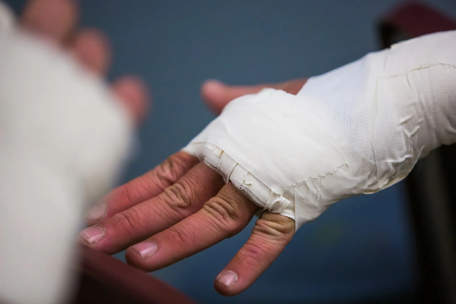 Burn injury attorney Queens: person with a bandaged hand and wrist
